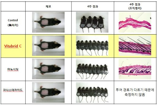 임상실험3