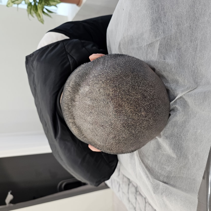 어떤게 두피문신이고 어떤게 내머리카락인가?