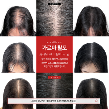 헤드샷스칼프 밀도채움