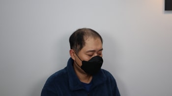 시술 전_좌반측면