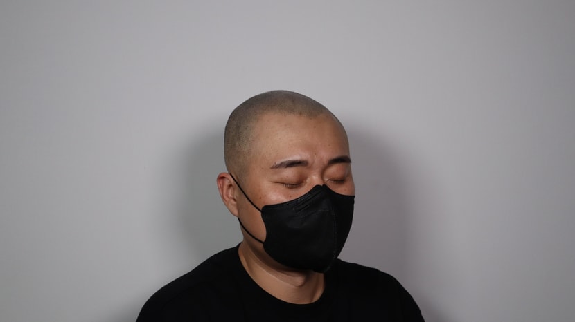 시술 후_좌반측면