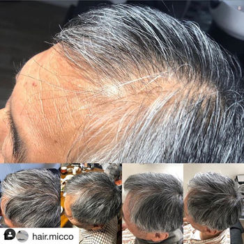 남성탈모(60대)사용후기