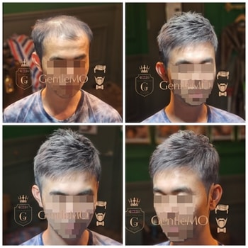 GentleMO # 가름마 펌디자인 / 클립방식착용