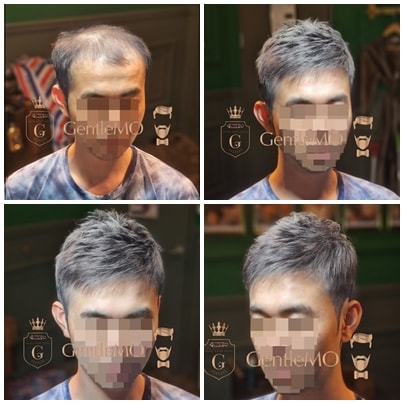 GentleMO # 가름마 펌디자인 / 클립방식착용