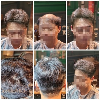 GentleMO # 앞머리를 살린 헤어스타일 / 고정형부착