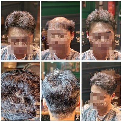 GentleMO # 앞머리를 살린 헤어스타일 / 고정형부착