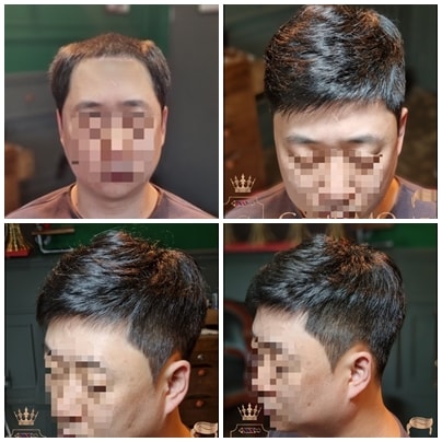 GentleMO # 모던한 다운펌 디자인 / 제티프식부착방식