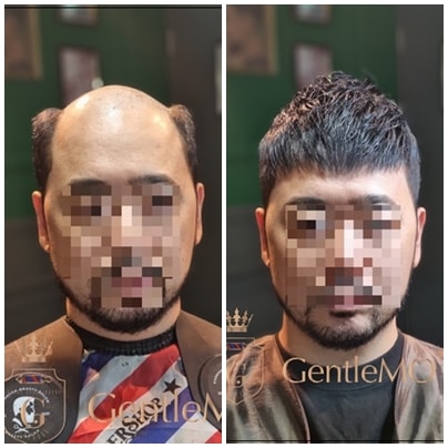 GentleMO # 모히칸 헤어스타일 / 테이프식부착