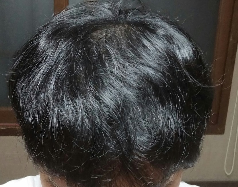 1차리터치하기 전 