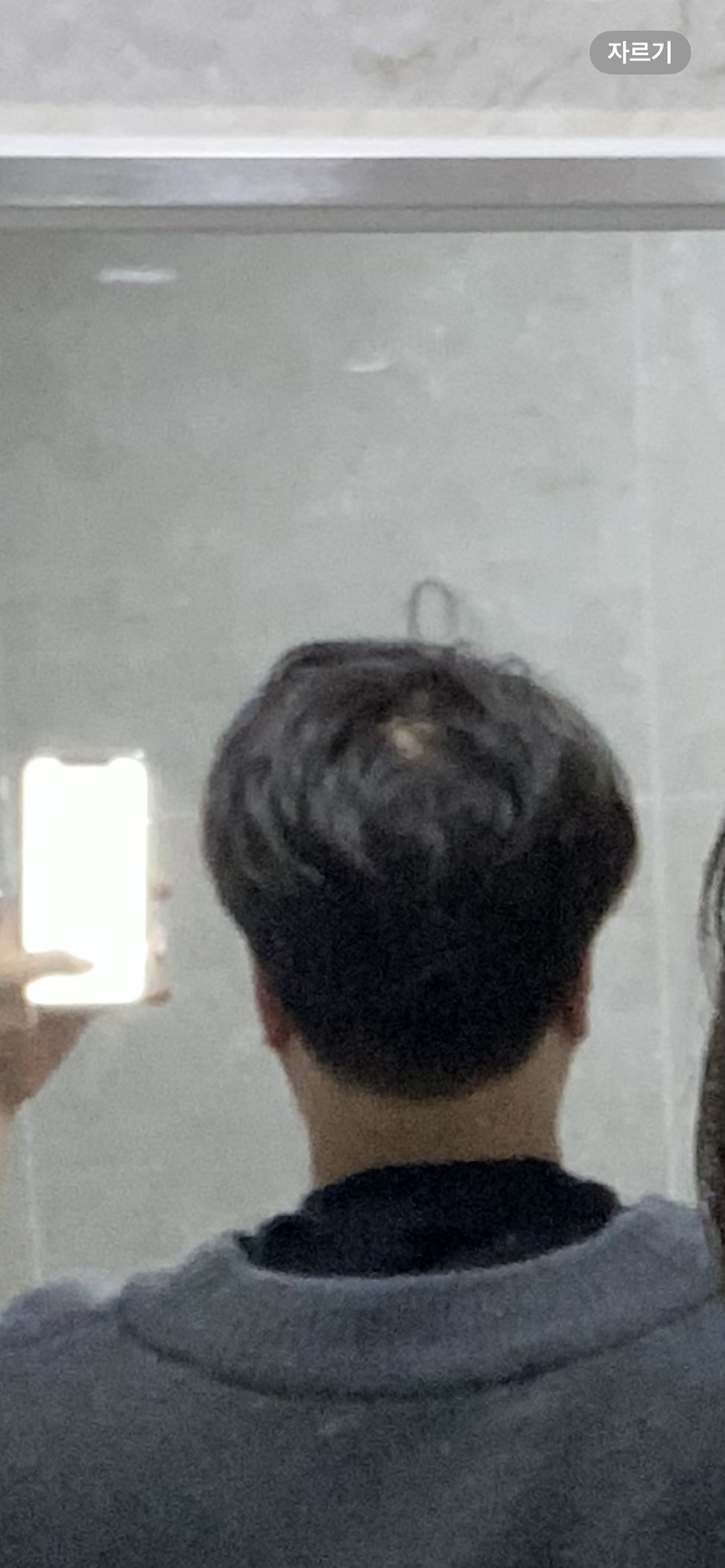 정수리