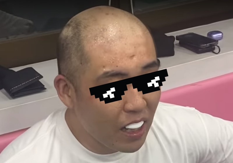 두피문신 삭발하고 드디어 받았어요