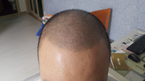 현재앞모습