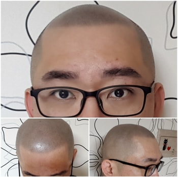 삭발 문신완료8주차(1mm바리깡 이발하고  2일 경과)