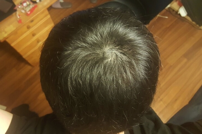 방금 찍은 최근 상태