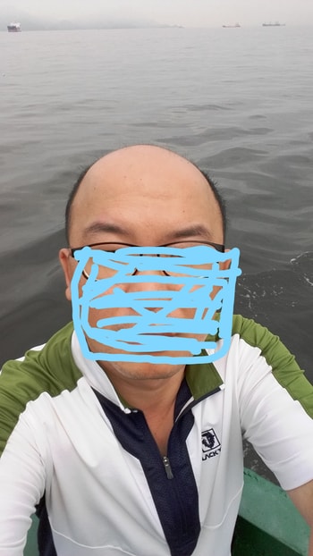 2016년 대머리였을때 암울한 사진 ㅎㅎ