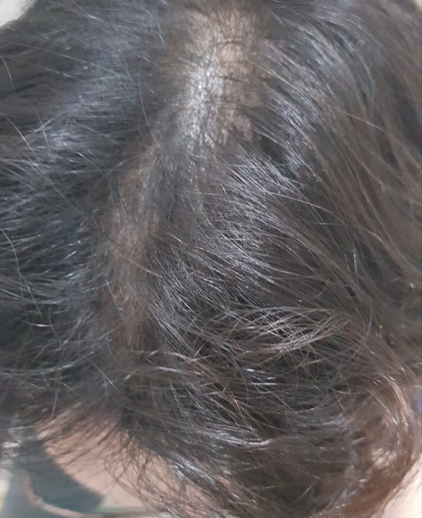 정수리 1