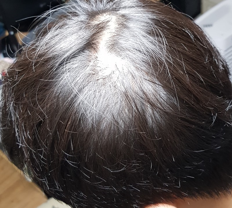 쌍가마, 두피문신 같이 알아보실분 + 경험자님 조언