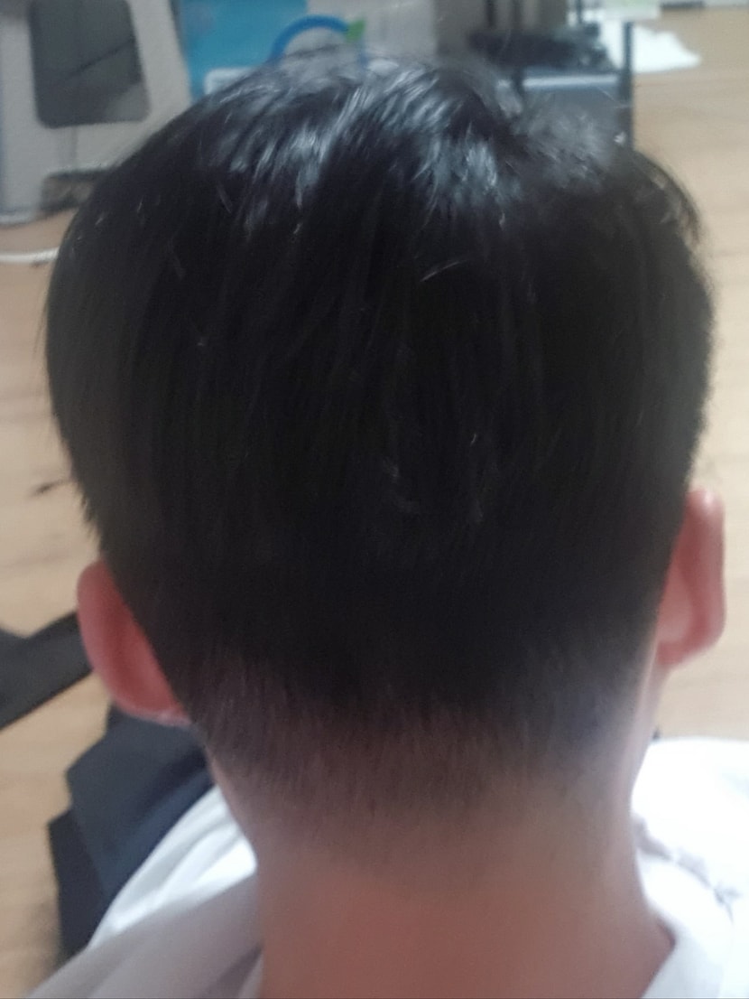 19년 증모술