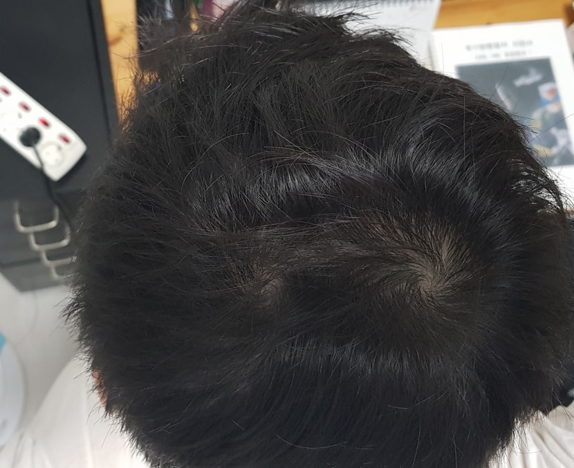 18년 가마 짧은머리