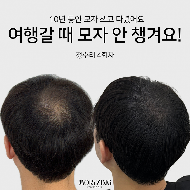 서울두피문신 28만 인플루언서도 방문하는 곳!