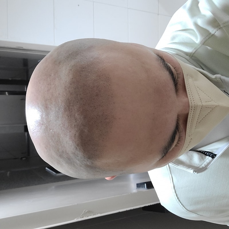 두피문신중입니다.