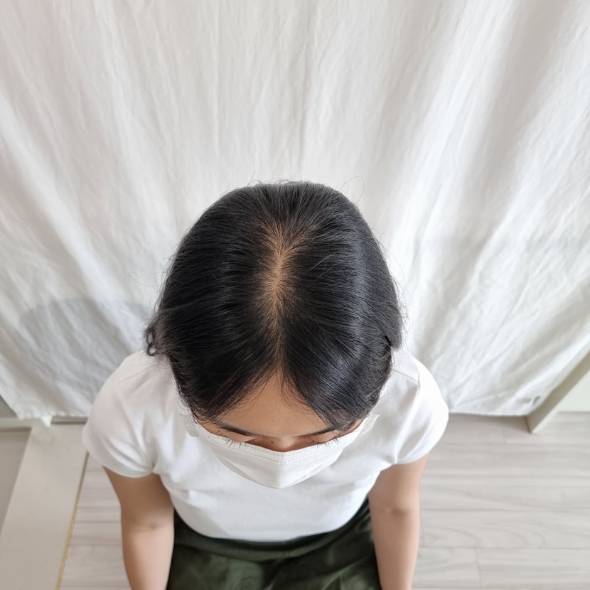 &lt;하기 전&gt;