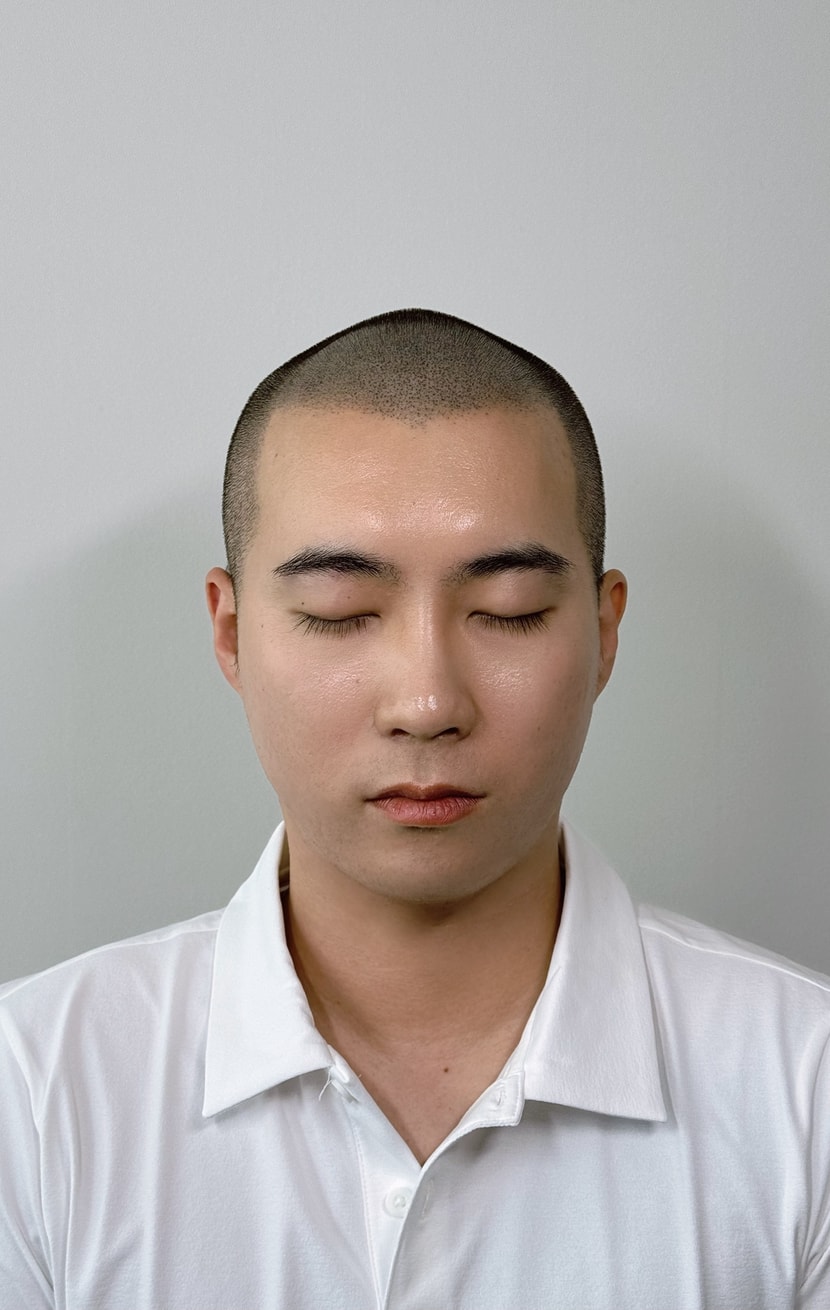 두피문신 완료