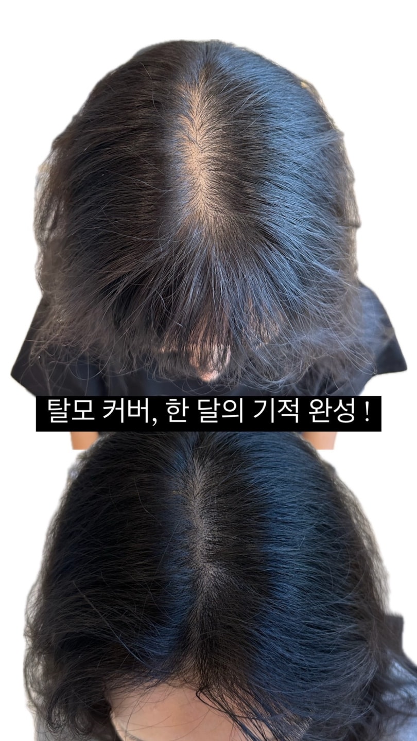 비포애프터