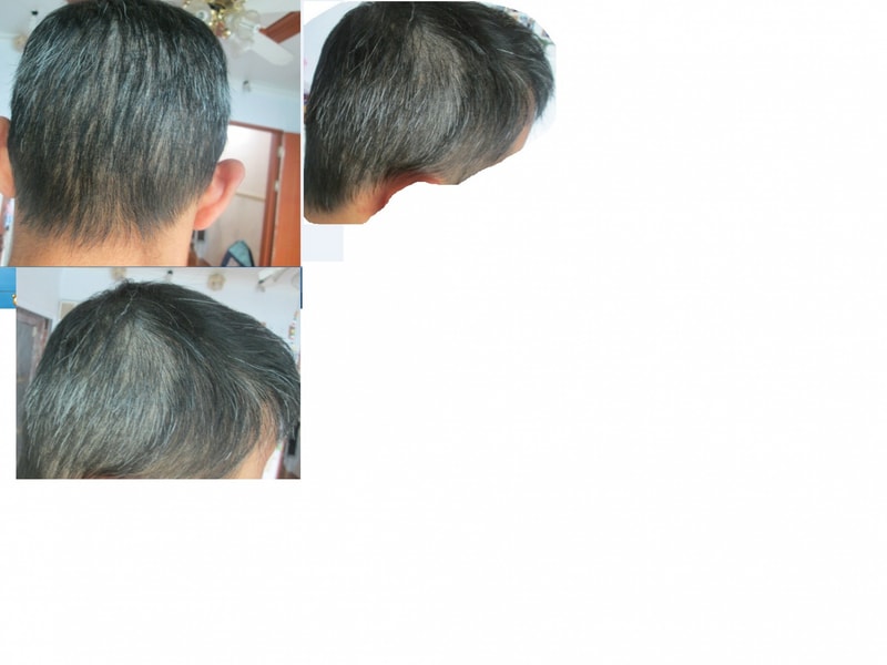 한듯 안한듯 자연스러운 두피문신을 하시려면 연하게 하세요