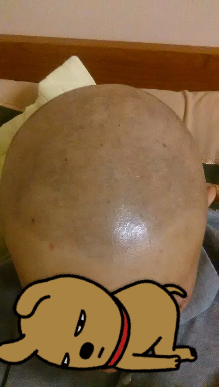 1차 사진