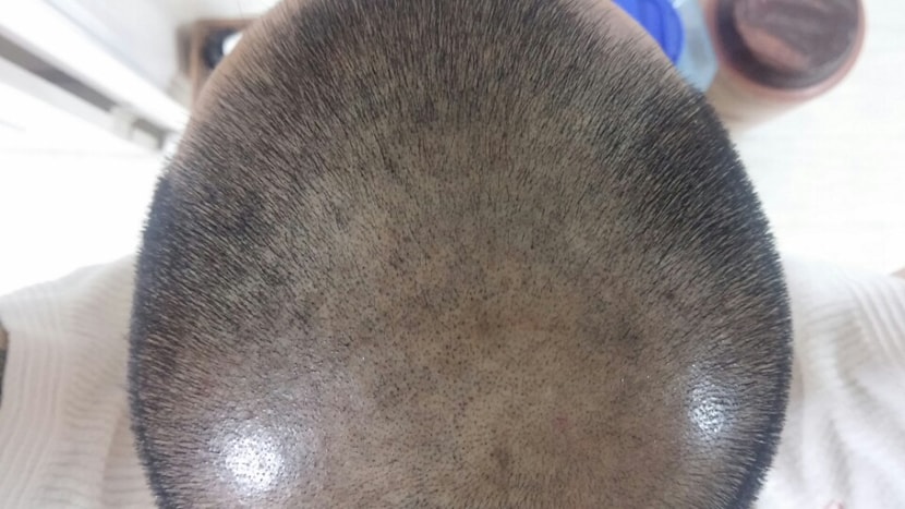 스마트폰 일반 사진