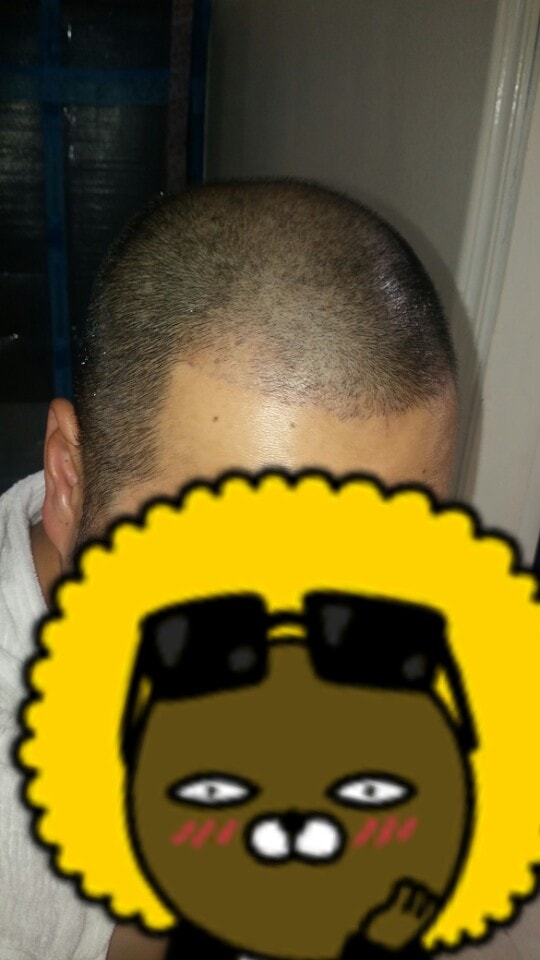 스마트폰 후레쉬 오른쪽 3자라인