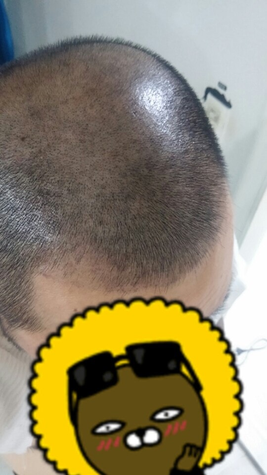 스마트폰 일반 사진