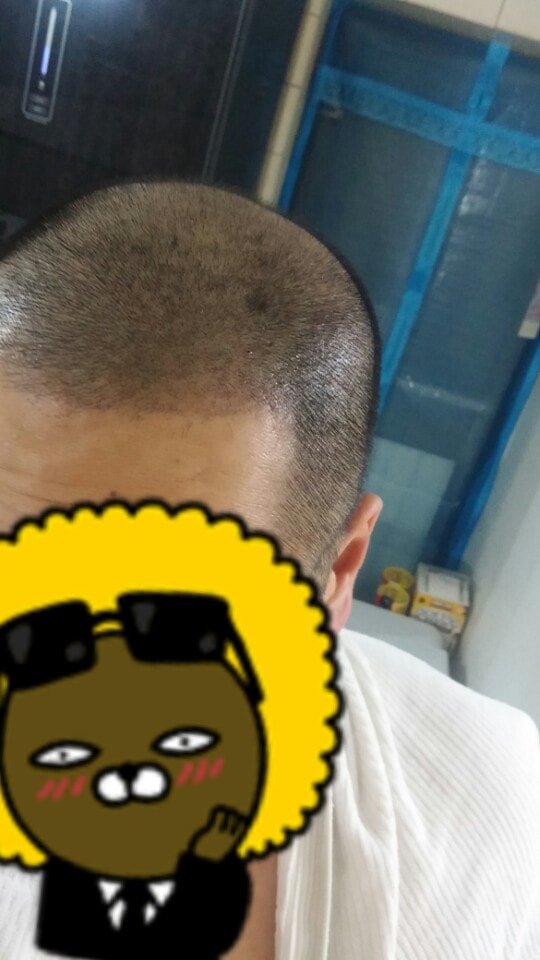 스마트폰 일반 왼쪽