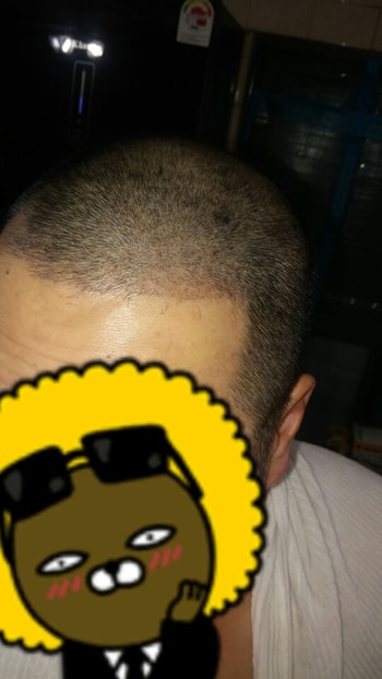 스마트폰 후레쉬 왼쪽 3자라인