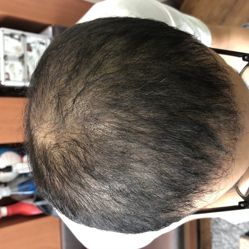 after