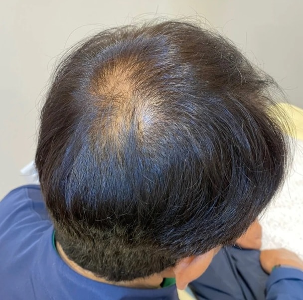 비포 모습이였어요ㅜㅜ