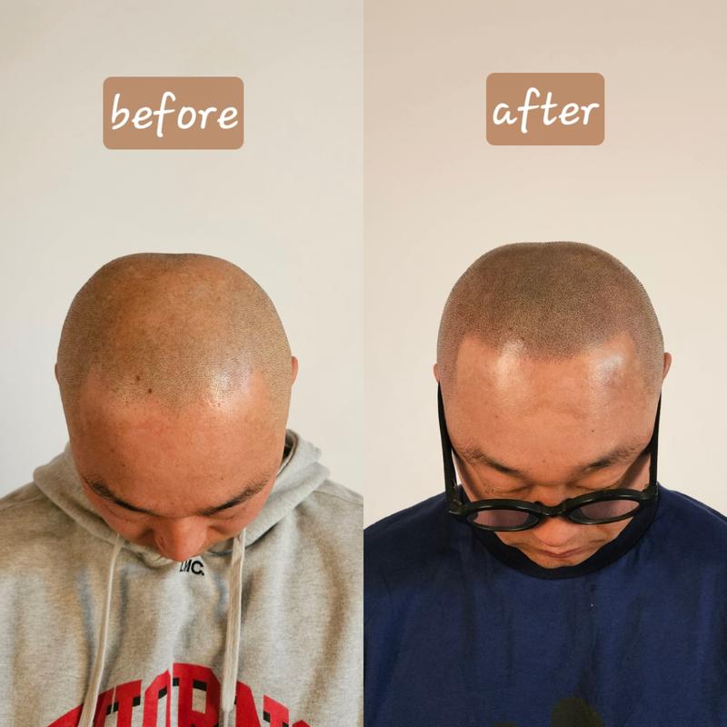 光头皮纹身后期