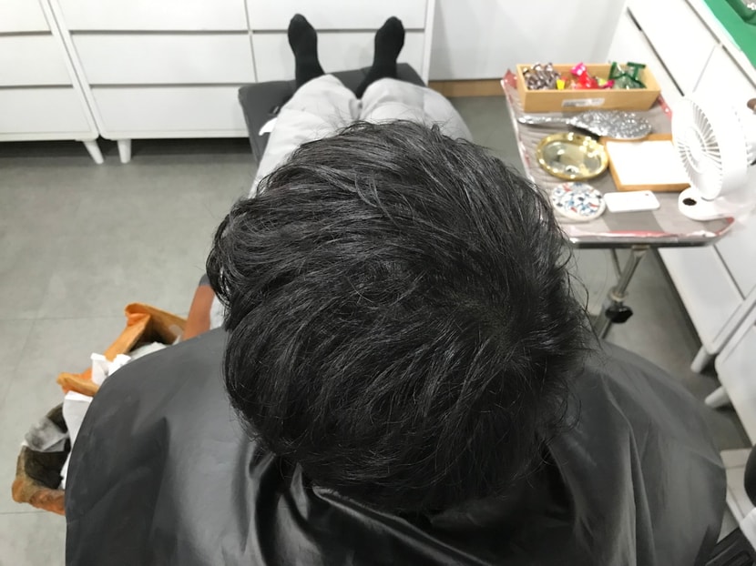시술 후