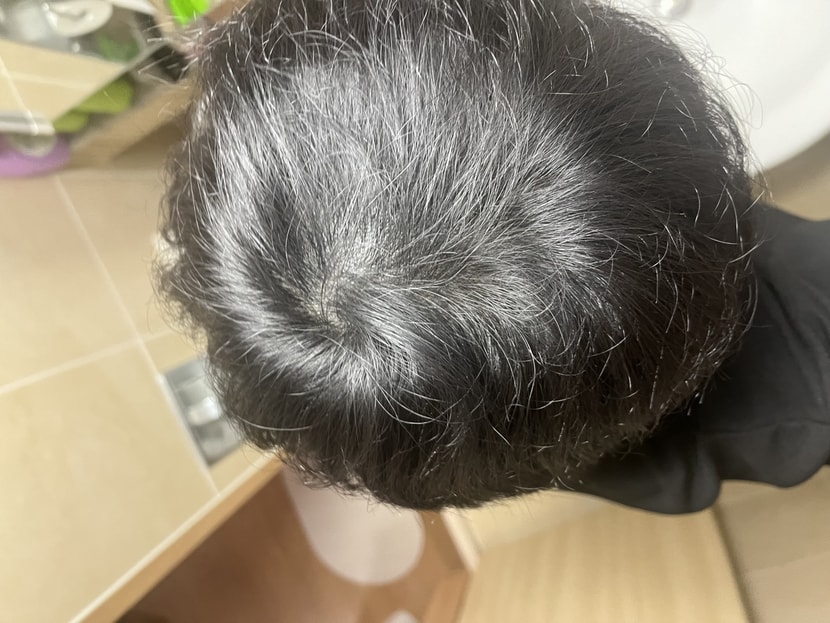 집에서 몇일 후 조명아래서 직접찍은 사진입니다