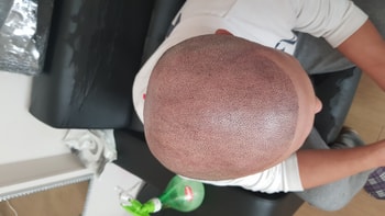사촌동생 오늘 했네요 정말 매직입니다