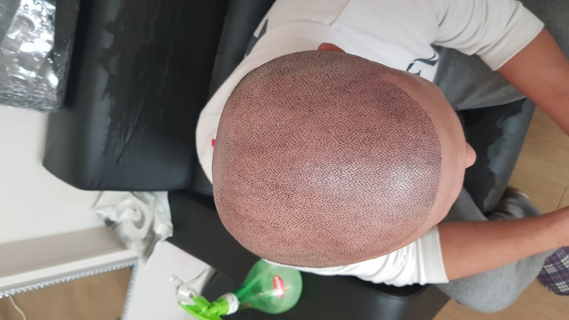 사촌동생 오늘 했네요 정말 매직입니다