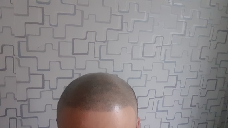 민머리 두피문신