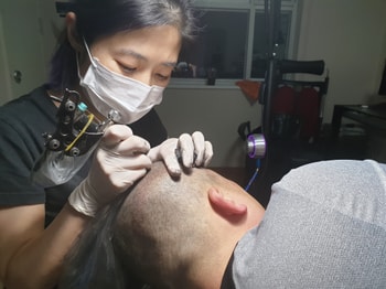요렇게 시술 됩니다 겁먹지 마세요 저는 첨에 엄청 무섭고 고민많이 했거든요