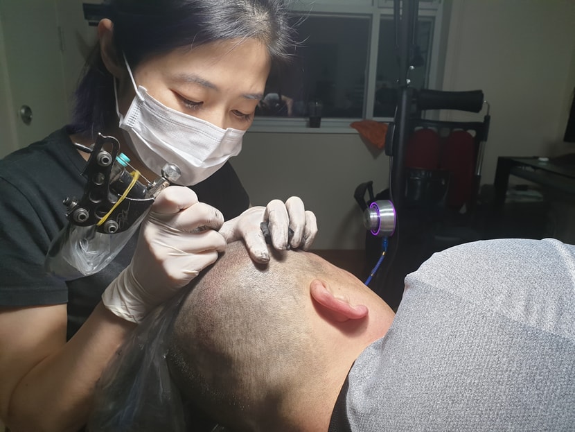 요렇게 시술 됩니다 겁먹지 마세요 저는 첨에 엄청 무섭고 고민많이 했거든요