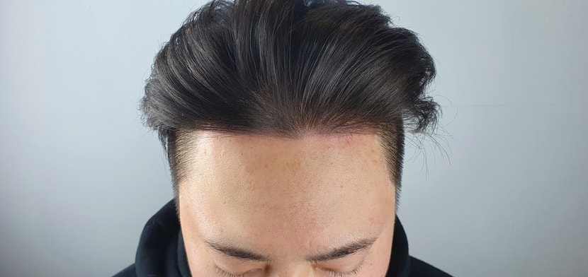 후