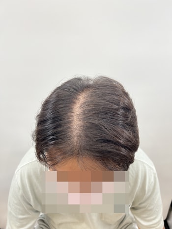 이 가르마 보다는 나아 지겠죠.... ㅎㅎ