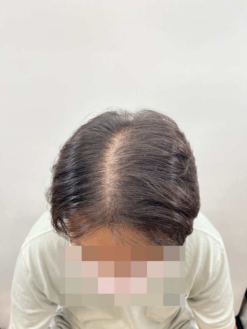 이 가르마 보다는 나아 지겠죠.... ㅎㅎ