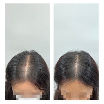 왼쪽이 비포 오른쪽이 에프터에요