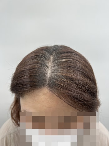 2차 에프터2